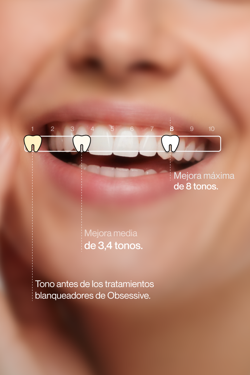 ROXO V34 - Branqueamento Dentário