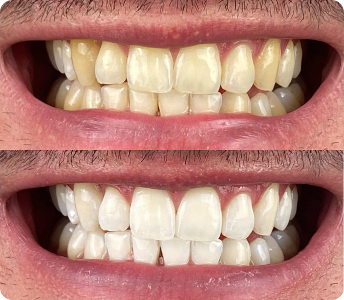 Antes y después