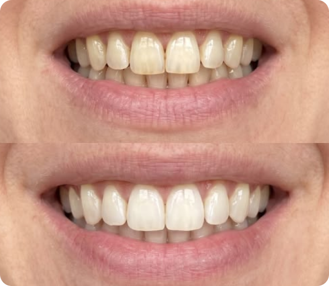 Antes y después