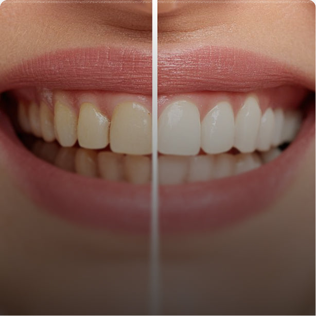 Clear Intensive Whitening Strips Test
