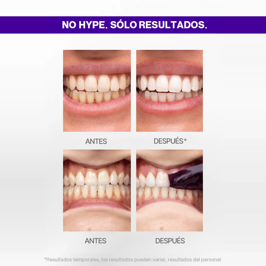 PURPLE STRIPS V34 - Tiras blanqueadoras