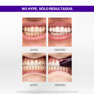 PURPLE STRIPS V34 - Whitening Strips