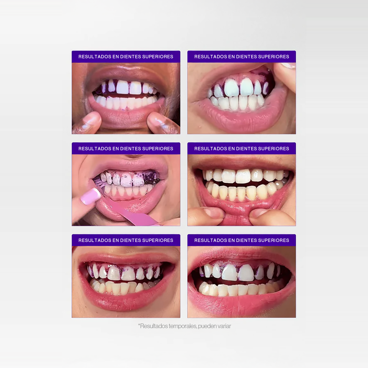 PURPLE STRIPS V34 - Whitening Strips