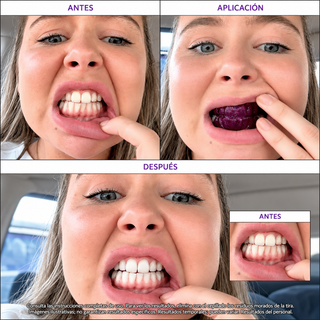 Purple Strips V34: antes, durante la aplicación y después