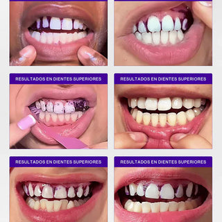 V34 Daily Whitening  Gel Test 2